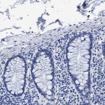 Immunohistochemistry-Paraffin: Hemogen Antibody [NBP1-84908]