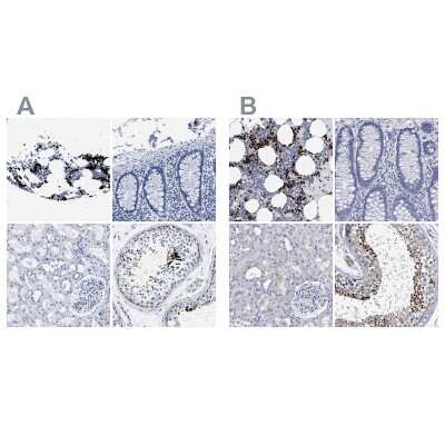 Immunohistochemistry-Paraffin: Hemogen Antibody [NBP1-84908]