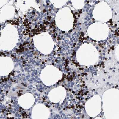Immunohistochemistry-Paraffin: Hemogen Antibody [NBP1-84909]