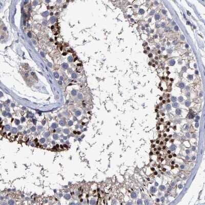 Immunohistochemistry-Paraffin: Hemogen Antibody [NBP1-84909]