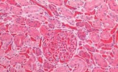 Immunohistochemistry-Paraffin: Hemoglobin A2 Antibody [NBP3-14370]