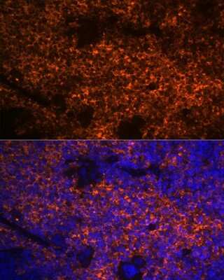 Immunohistochemistry: Hemoglobin A1 Antibody (1R1N7) [NBP3-16804]