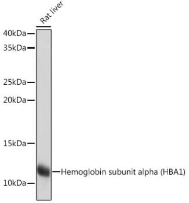 Western Blot: Hemoglobin A1 Antibody (1R1N7) [NBP3-16804]