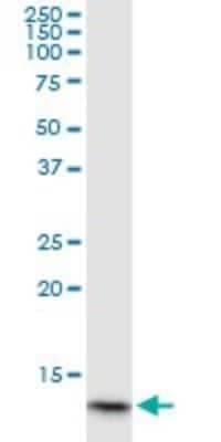 Western Blot: Hemoglobin A1 Antibody (4F9) [H00003039-M02]