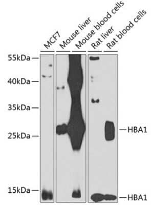 Western Blot: Hemoglobin A1 AntibodyBSA Free [NBP3-05568]