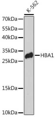 Western Blot: Hemoglobin A1 AntibodyAzide and BSA Free [NBP3-05570]