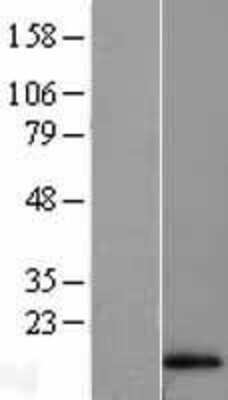 Western Blot: Hemoglobin A1 Overexpression Lysate [NBL1-11454]