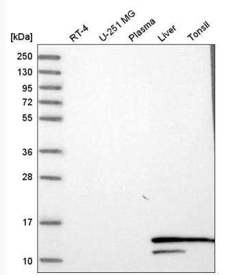 Western Blot: Hemoglobin A1 Antibody [NBP2-54711]