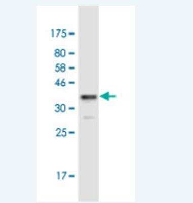 Western Blot: Hemoglobin beta Antibody (7B24) [H00003043-M12-100ug]