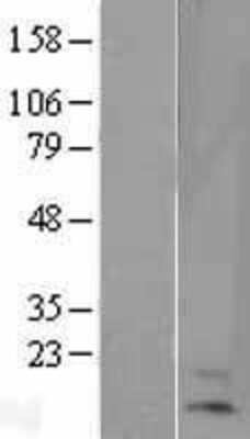 Western Blot: Hemoglobin beta Overexpression Lysate [NBL1-11456]