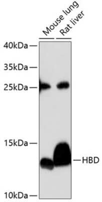 Western Blot: Hemoglobin delta AntibodyAzide and BSA Free [NBP3-03278]