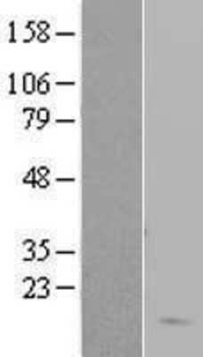 Western Blot: Hemoglobin delta Overexpression Lysate [NBL1-11457]