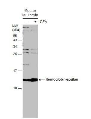 Western Blot: Hemoglobin epsilon Antibody [NBP2-43557]