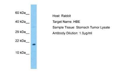 Western Blot: Hemoglobin epsilon Antibody [NBP2-84061]