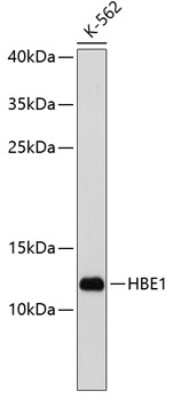 Western Blot: Hemoglobin epsilon AntibodyBSA Free [NBP3-03279]