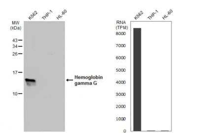 Western Blot: HBG1/2 Antibody [NBP2-16806]