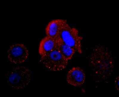 Immunocytochemistry/ Immunofluorescence: HBG1/2 Antibody (JM84-10) [NBP2-66885]