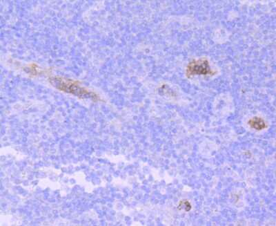Immunohistochemistry-Paraffin: HBG1/2 Antibody (JM84-10) [NBP2-66885]