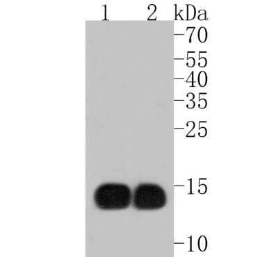 Western Blot: HBG1/2 Antibody (JM84-10) [NBP2-66885]