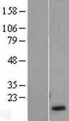 Western Blot: HBG1/2 Overexpression Lysate [NBL1-11460]