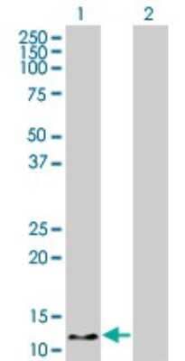 Western Blot: Hemoglobin zeta Antibody (1G10) [H00003050-M03]