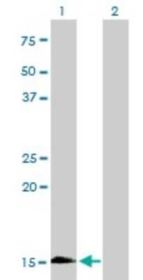 Western Blot: Hemoglobin zeta Antibody (3C4-1D5) [H00003050-M01]