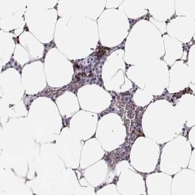 Immunohistochemistry: Hemoglobin zeta Antibody [NBP2-68924]