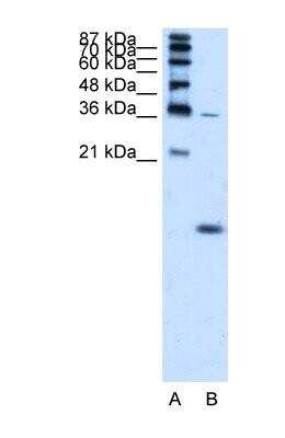 Western Blot: Hemoglobin zeta Antibody [NBP1-56354]