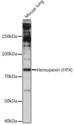 Western Blot: Hemopexin Antibody (1M6O3) [NBP3-16762]