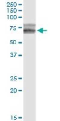 Western Blot: Hemopexin Antibody (3A9-1A9) [H00003263-M01]