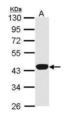 Western Blot: Hemopexin Antibody [NBP1-31713]