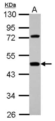 Western Blot: Hemopexin Antibody [NBP2-16807]