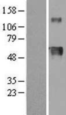 Western Blot: Hemopexin Overexpression Lysate [NBL1-11702]