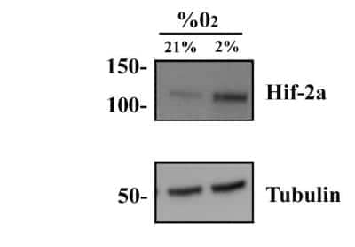 Western Blot: HepG2 Hypoxic / Normoxic Cell Lysate [NBP2-36453]