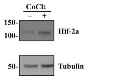 Western Blot: HepG2 CoCl2 treated/Untreated Cell Lysate [NBP2-36451]