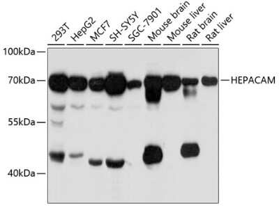 Western Blot: HepaCAM AntibodyAzide and BSA Free [NBP3-04983]