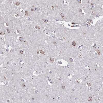 Immunohistochemistry-Paraffin: Heparan Sulfate 2-O-Sulfotransferase 1/HS2ST1 Antibody [NBP1-91982]