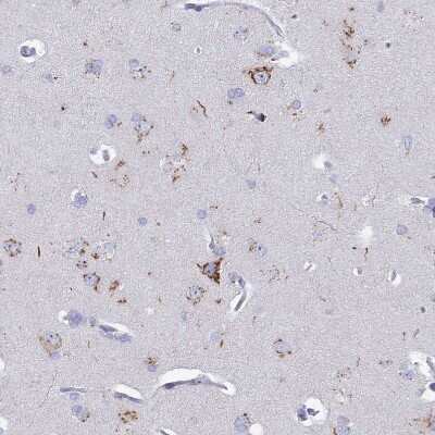 Immunohistochemistry-Paraffin: Heparan Sulfate 2-O-Sulfotransferase 1/HS2ST1 Antibody [NBP1-91982]