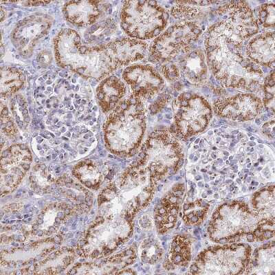 Immunohistochemistry-Paraffin: Heparan Sulfate 2-O-Sulfotransferase 1/HS2ST1 Antibody [NBP1-91982]