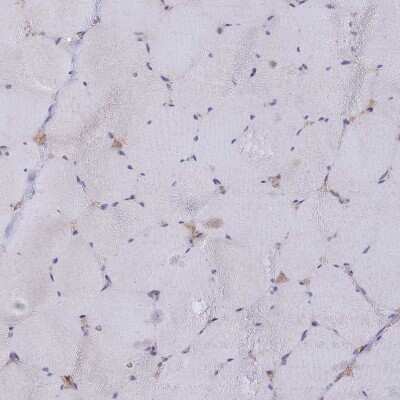 Immunohistochemistry-Paraffin: Heparan Sulfate 2-O-Sulfotransferase 1/HS2ST1 Antibody [NBP1-91982]