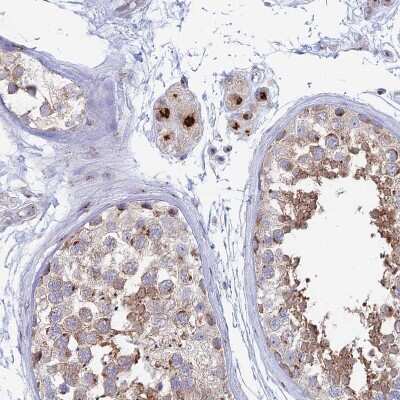 Immunohistochemistry-Paraffin: Heparan Sulfate 2-O-Sulfotransferase 1/HS2ST1 Antibody [NBP1-91982]