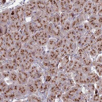 Immunohistochemistry-Paraffin: Heparan Sulfate 2-O-Sulfotransferase 1/HS2ST1 Antibody [NBP1-91983]