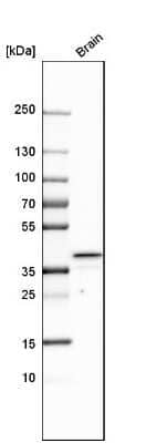 Western Blot: Heparan Sulfate 3-O-Sulfotransferase 1/HS3ST1 Antibody [NBP1-89375]