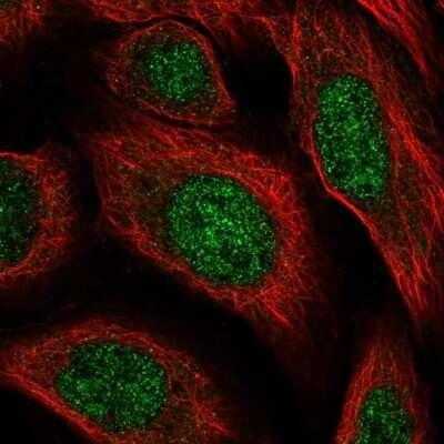 Immunocytochemistry/ Immunofluorescence: Heparan Sulfate 6-O-Sulfotransferase 2/HS6ST2 Antibody [NBP2-56735]