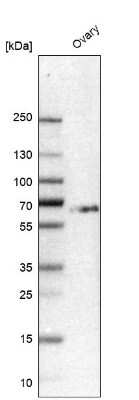 Western Blot: Heparan Sulfate 6-O-Sulfotransferase 2/HS6ST2 Antibody [NBP2-56735]