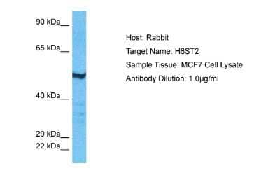 Western Blot: Heparan Sulfate 6-O-Sulfotransferase 2/HS6ST2 Antibody [NBP2-87560]