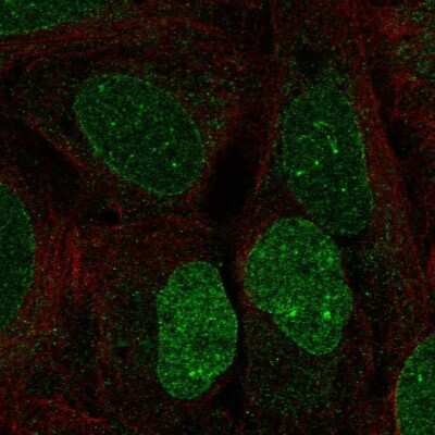 Immunocytochemistry/ Immunofluorescence: Heparan Sulfate 6-O-Sulfotransferase 3/HS6ST3 Antibody [NBP2-69063]