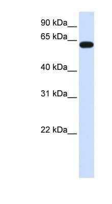 Western Blot: Heparan Sulfate 6-O-Sulfotransferase 3/HS6ST3 Antibody [NBP1-91328]