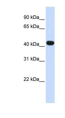 Western Blot: Heparan Sulfate Glucosamine 3-O-Sulfotransferase 3 Antibody [NBP1-91295]