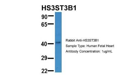 Western Blot: Heparan Sulfate Glucosamine 3-O-Sulfotransferase 3 Antibody [NBP1-91295]